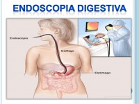 Endoscopia del aparato digestivo.