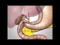 Colangiopancreatografia retrograda endoscopica.